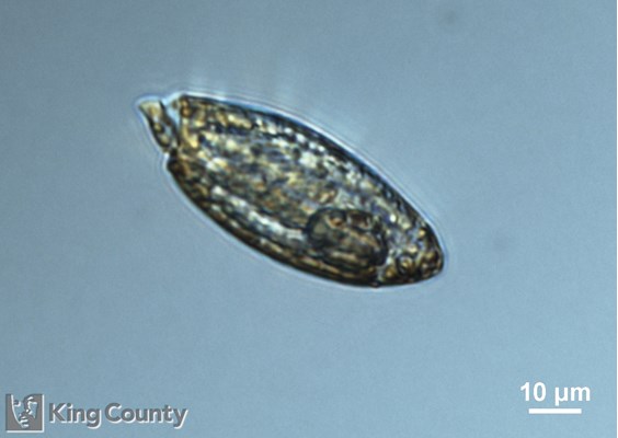 Photo of Torodinium cf. robustum